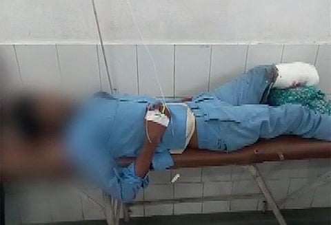 உ.பி. மருத்துவமனையில் நோயாளியின் துண்டிக்கப்பட்ட காலை தலையணையாக்கிய மருத்துவ ஊழியர்கள்!