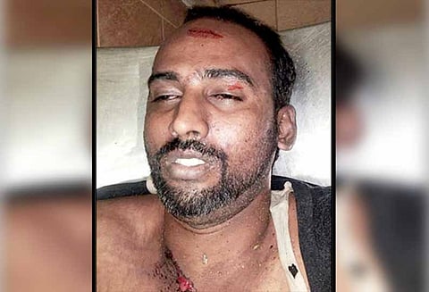 செல்போன் பேசிக்கொண்டு மோட்டார் சைக்கிளில் சென்றபோது மின்னல் தாக்கி தொழிலாளி சாவு