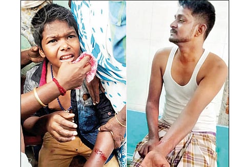 திருச்சி அரியமங்கலத்தில் பரபரப்பு: தெரு நாய்கள் கடித்து சிறுவர்கள் உள்பட 4 பேர் காயம் பொதுமக்கள் சாலைமறியல்