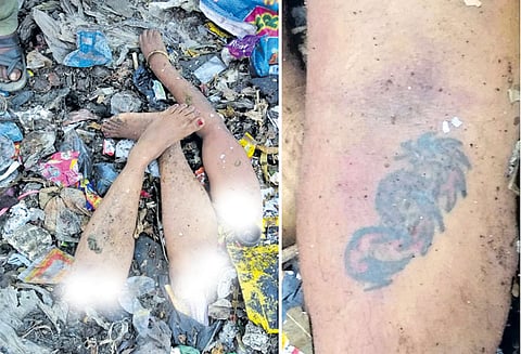 குப்பை கிடங்கில் பெண்ணின் கை, கால்கள்: உடலை தேடும் போலீசார் குற்றவாளிகளை பிடிக்க 2 தனிப்படைகள் அமைத்து தீவிரம்