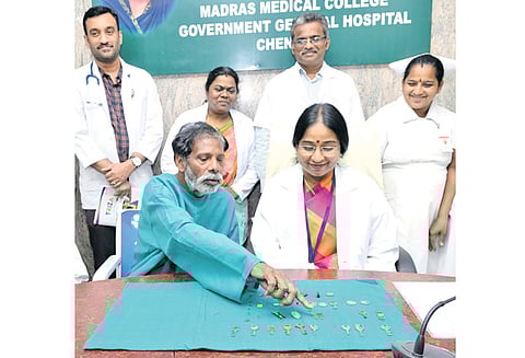 சென்னை அரசு மருத்துவமனையில் மனநோயாளி வயிற்றில் இருந்து சாவி, காசு உள்பட 40 பொருட்கள் அகற்றம்