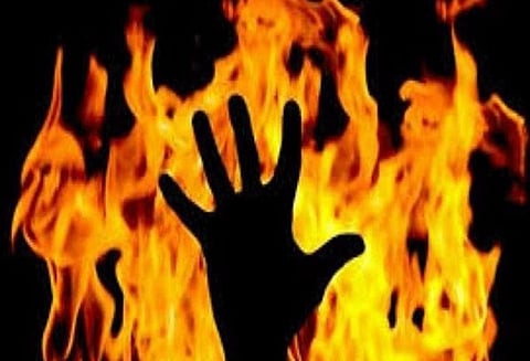 மத்தூர் அருகே தீக்காயம் அடைந்த பெண் சாவு