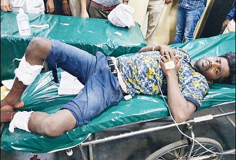 பெங்களூருவில் போலீசாரை அரிவாளால் தாக்க முயன்ற ரவுடி மீது துப்பாக்கிச்சூடு