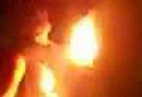 தேவாரம் அருகே தீக்குளித்து தற்கொலைக்கு முயன்ற பெண் மருத்துவமனையில் அனுமதி