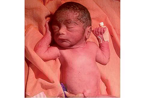 ஆண் குழந்தை முட்புதரில் வீச்சு