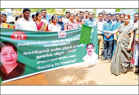 காசநோய் கண்டறியும் முகாம் மாவட்டம் முழுவதும் 4-ந்தேதி வரை நடக்கிறது