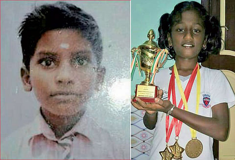 ராமநாதபுரத்தில் டெங்கு காய்ச்சலுக்கு தடகள இளம் வீராங்கனை- சிறுவன் பலி