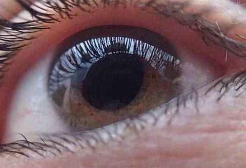 தீபாவளி ராக்கெட்டால் ஏற்பட்ட விபரீதம்: கண்பார்வையை இழந்த மாணவி