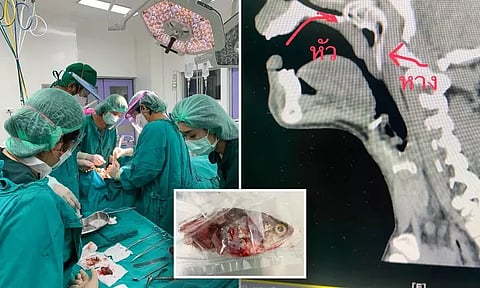 தூண்டில் போட்டவரின் தொண்டைக்குள் துள்ளி குதித்த மீன்... விசித்திர சம்பவம்