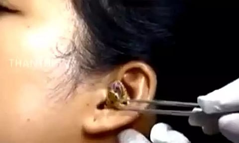 பெண்ணின் காதுக்குள் புகுந்த பாம்பு - நெஞ்சை பதைபதைக்கும் வீடியோ