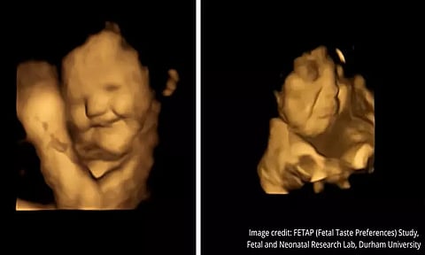 Image Tweeted By @durham_uni