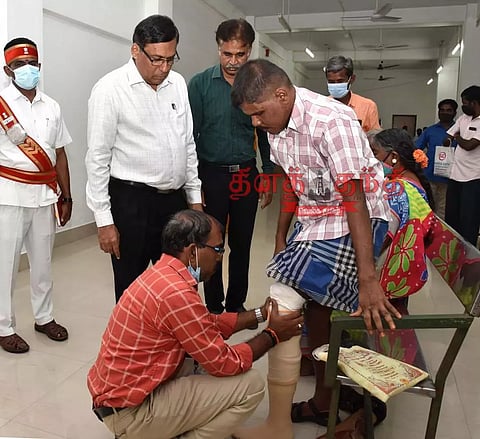 மாற்றுத்திறனாளிக்கு செயற்கை கால்