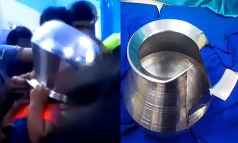 ராணிப்பேட்டை: ஒன்றரை வயது குழந்தையின் தலையில் மாட்டிய பாத்திரம்...! பதறி துடித்த பெற்றோர்