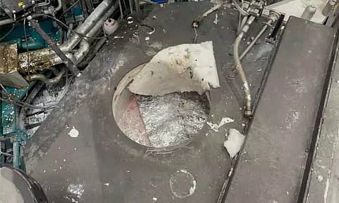 720 டிகிரி உருகிய அலுமினியத்தில் விழுந்து அதிர்ஷ்டவசமாக உயிர் தப்பிய நபர்