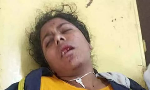 கல்லூரி விடுதியின் 3-வது மாடியில் இருந்து குதித்து நர்சிங் மாணவி தற்கொலை முயற்சி