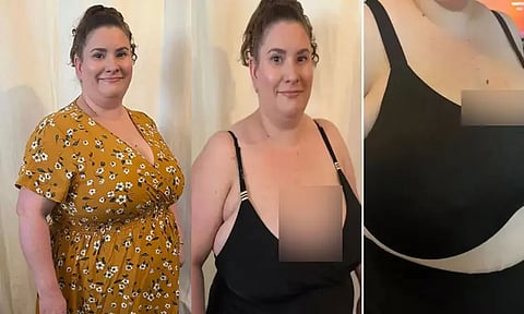 எங்கு போனாலும் இடிக்கிறது... பெரிய மார்பை குறைக்க நிதி திரட்டி வரும் பெண்