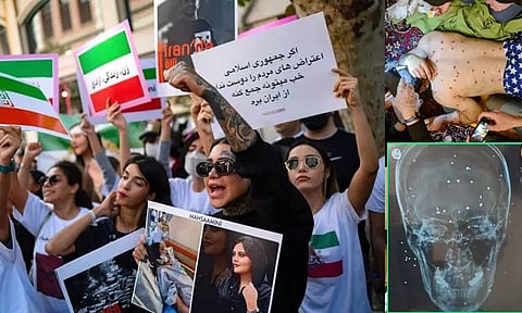 ஈரான்: ஹிஜாப் எதிர்ப்பு போராட்டத்தில் பெண்களின் கண்கள், மார்பு, பிறப்புறுப்பை குறிவைத்து துப்பாக்கிச்சூடு - பகீர் தகவல்