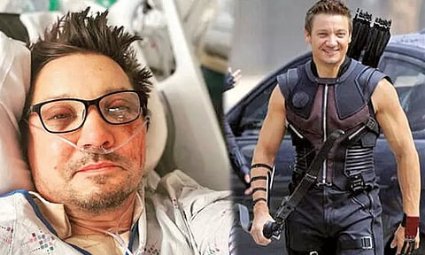 விபத்தில் சிக்கிய 'அவெஞ்சர்' நடிகருக்கு 30 எலும்புகள் முறிந்தன