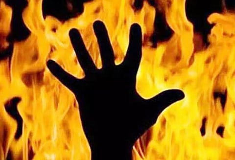 போலீஸ் சூப்பிரண்டு அலுவலகம் முன்பு தீக்குளித்து தற்கொலைக்கு முயன்ற போலீஸ்காரர்