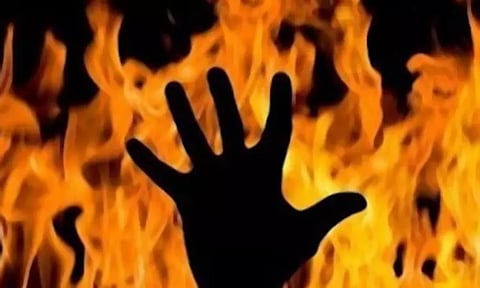 ஓய்வூதிய நிலுவை தொகையை தராமல் அலைக்கழிப்பு மாநகராட்சி தூய்மை பணியாளர் மகன் தீக்குளிப்பு