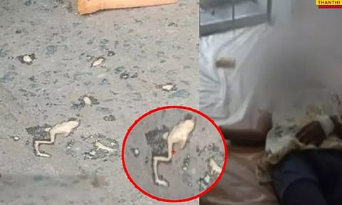 மதுரை: தவளை இறந்து கிடந்த ஐஸ்கிரீம் சாப்பிட்ட குழந்தைகளுக்கு உடல்நலக்குறைவு - தீவிர சிகிச்சை