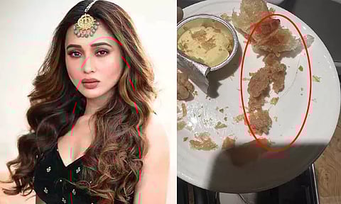 எமிரேட்ஸ் விமானத்தில் வழங்கிய உணவில் நீண்ட முடி; பெண் எம்.பி. அதிர்ச்சி