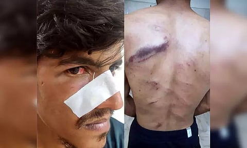 காதல் தகராறில் துணை நடிகரை கடத்தி தாக்குதல் - காதலியின் உறவினர்கள் மீது புகார்