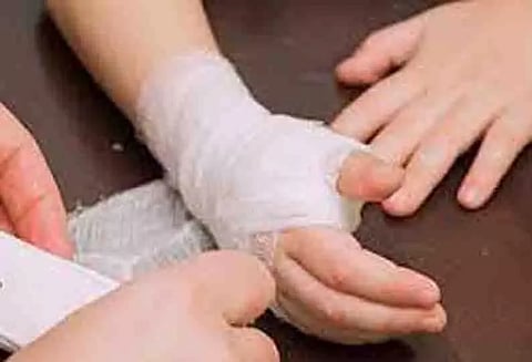 சமையல் செய்யும்போது தீப்பிடித்து பெண் காயம்