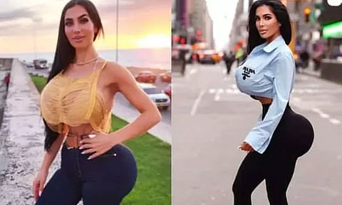 பிரபல ஹாலிவுட் நடிகை போல மாற ஆசை...! அறுவை சிகிச்சையால் மாடல் அழகி மரணம்