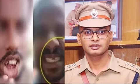 பற்களை பிடுங்கிய விவகாரம்: பல்வீர் சிங் மீது வன்கொடுமை தடுப்பு சட்டத்தின் கீழ் வழக்குப்பதிவு