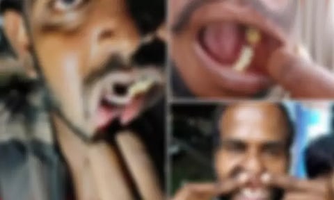 பற்களை பிடுங்கிய விவகாரம்: மேலும் 2 காவலர்கள் மீது வழக்குப்பதிவு..!