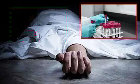 பாகிஸ்தானின் கராச்சியில் காங்கோ வைரசுக்கு நடப்பு ஆண்டில் முதல் உயிரிழப்பு பதிவு