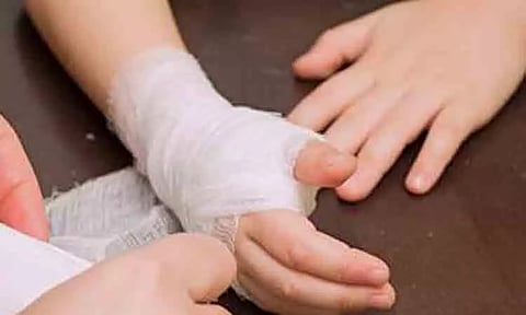 கதம்ப வண்டு கொட்டி 5 பெண்கள் காயம்