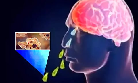 கேரளாவில் அமீபா மூலம் ஏற்படும் அரியவகை மூளை நோய்க்கு 15-வயது சிறுவன் பலி