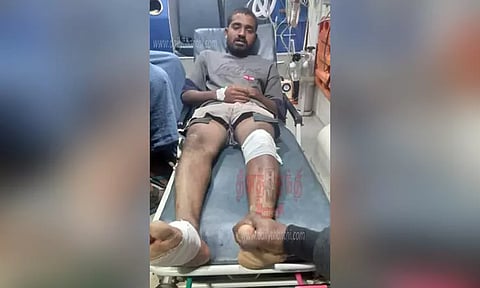 காட்டு யானை தாக்கியதாக நாடகம்