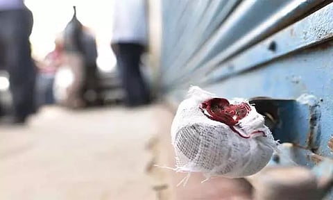 சாலை விரிவாக்க பணிக்காக இடிக்க முடிவு மாநகராட்சி வணிக வளாக கட்டிடத்துக்கு 'சீல்'