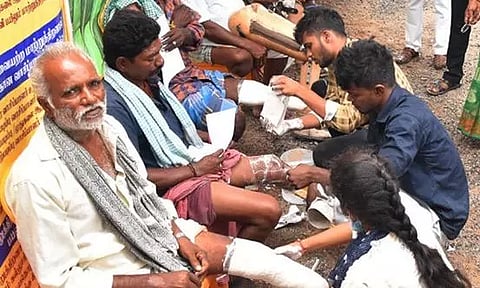 செயற்கை உபகரணங்கள் வழங்குவதற்காக அளவீடு செய்யும் முகாம்