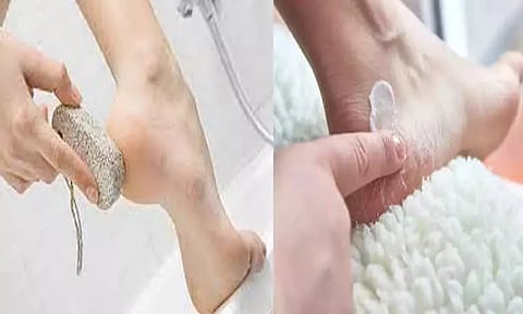 சர்க்கரை நோயாளிகள் பாதங்களைப் பேணுவது ஏன் முக்கியம்?