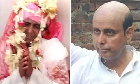 வழுக்கை தலையை மறைத்து விக்: 2வது திருமணம் செய்ய முயன்ற மாப்பிள்ளைக்கு அடி உதை