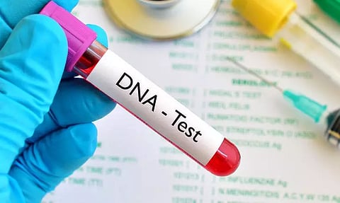 4 சிறுவர்களுக்கு டி.என்.ஏ. பரிசோதனை நடத்த அனுமதி