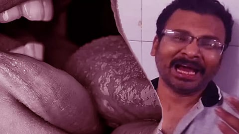 லிப்-லாக் முத்தம் கொடுத்த கணவன் நாக்கை கடித்து துண்டாக்கிய மனைவி