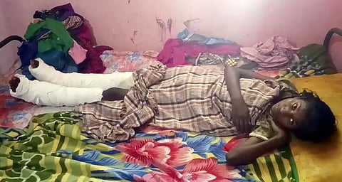 அரசு திட்ட பணி விளக்க சுவர் இடிந்து மாணவி கால்கள் முறிந்தது