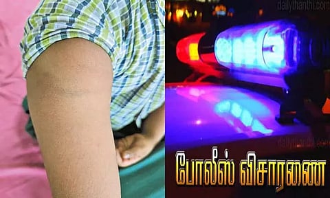 வீட்டுப்பாடம் எழுதவில்லை என ஆசிரியை பிரம்பால் அடித்ததில் 4-ம் வகுப்பு மாணவி காயம்