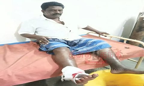 வெறிநாய்கள் கடித்து குதறியதில் பெண்கள் உள்பட 66 பேர் காயம்