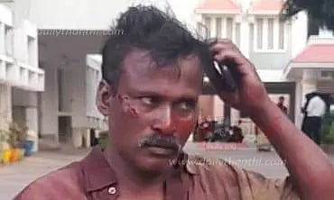 நாகர்கோவிலில் ரத்த காயங்களுடன் போலீஸ் சூப்பிரண்டு அலுவலகம் வந்த டிரைவர்