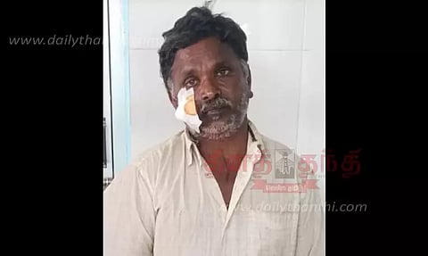 வீட்டில் தூங்கிய பெண்ணிடம் சங்கிலி பறித்தவர் கைது