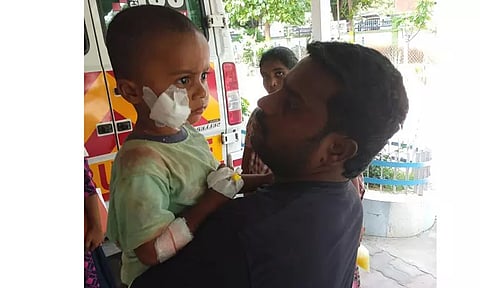 வெறி நாய் கடித்து குழந்தை உள்பட 2 பேர் படுகாயம்