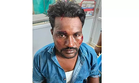 ஆக்கிரமித்து வீடு கட்டியதில் தகராறு: ஊராட்சி மன்ற தலைவருக்கு அரிவாள் வெட்டு;3 பேர் கைது