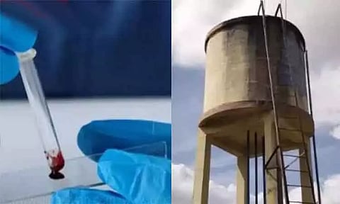 வேங்கைவயல் வழக்கு; மேலும் 5 பேருக்கு டி.என்.ஏ. பரிசோதனை