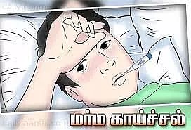 வேகமாக பரவும் மர்ம காய்ச்சல்
